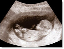 antenatal scan