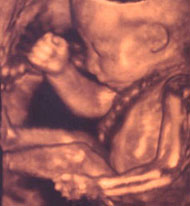 fetus