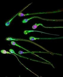 human sperm cells